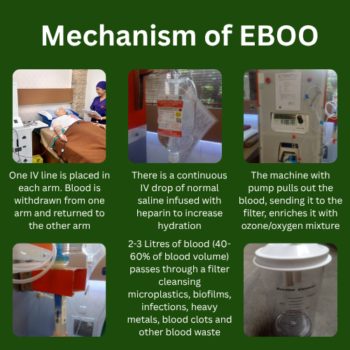 EBOO Mechanism